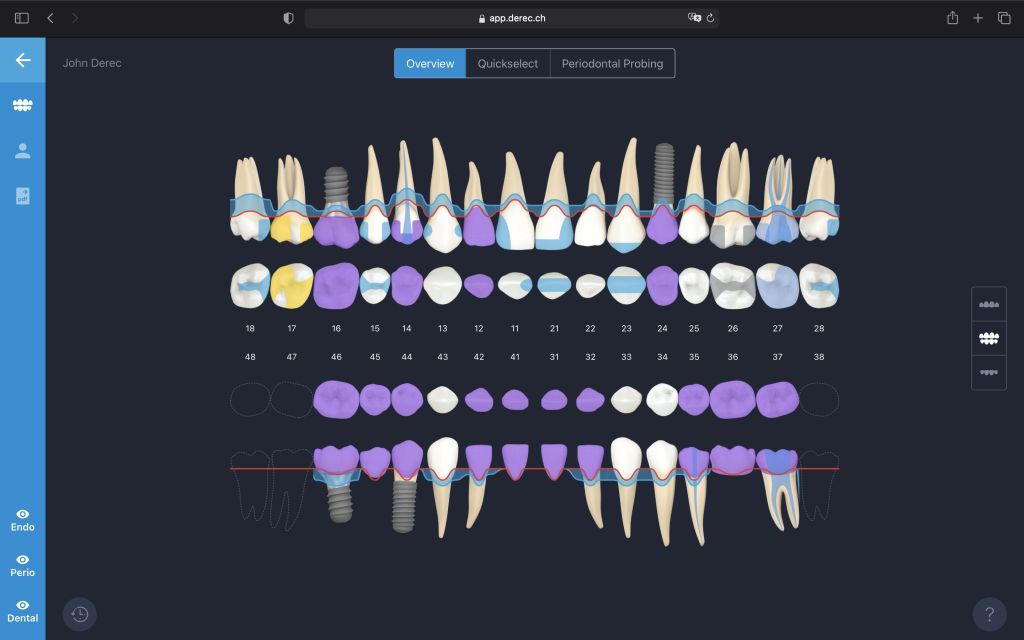 derec - Online Dental Charting
